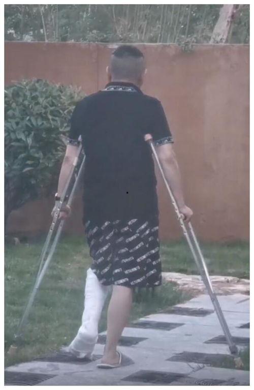 骨折石膏视频,骨折石膏固定术操作步骤及注意事项解析