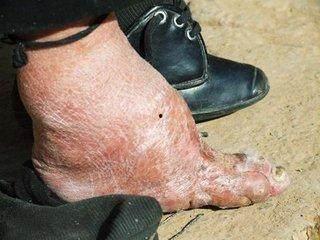 三寸金莲图片大全图片,古代女性足部束缚的神秘美学