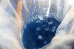 全世界最大的脓包视频,一场视觉震撼的医学奇观